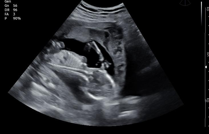 Picture14