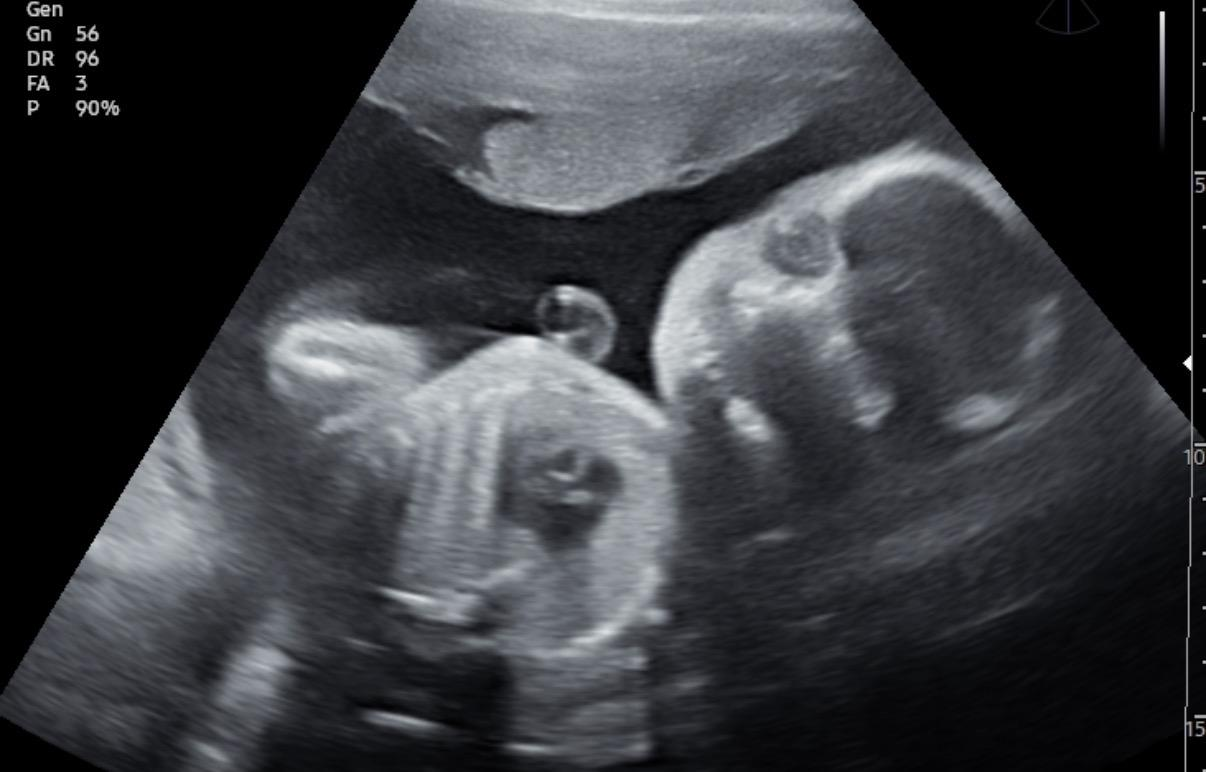 Picture15