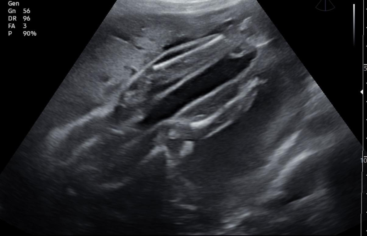 Picture16