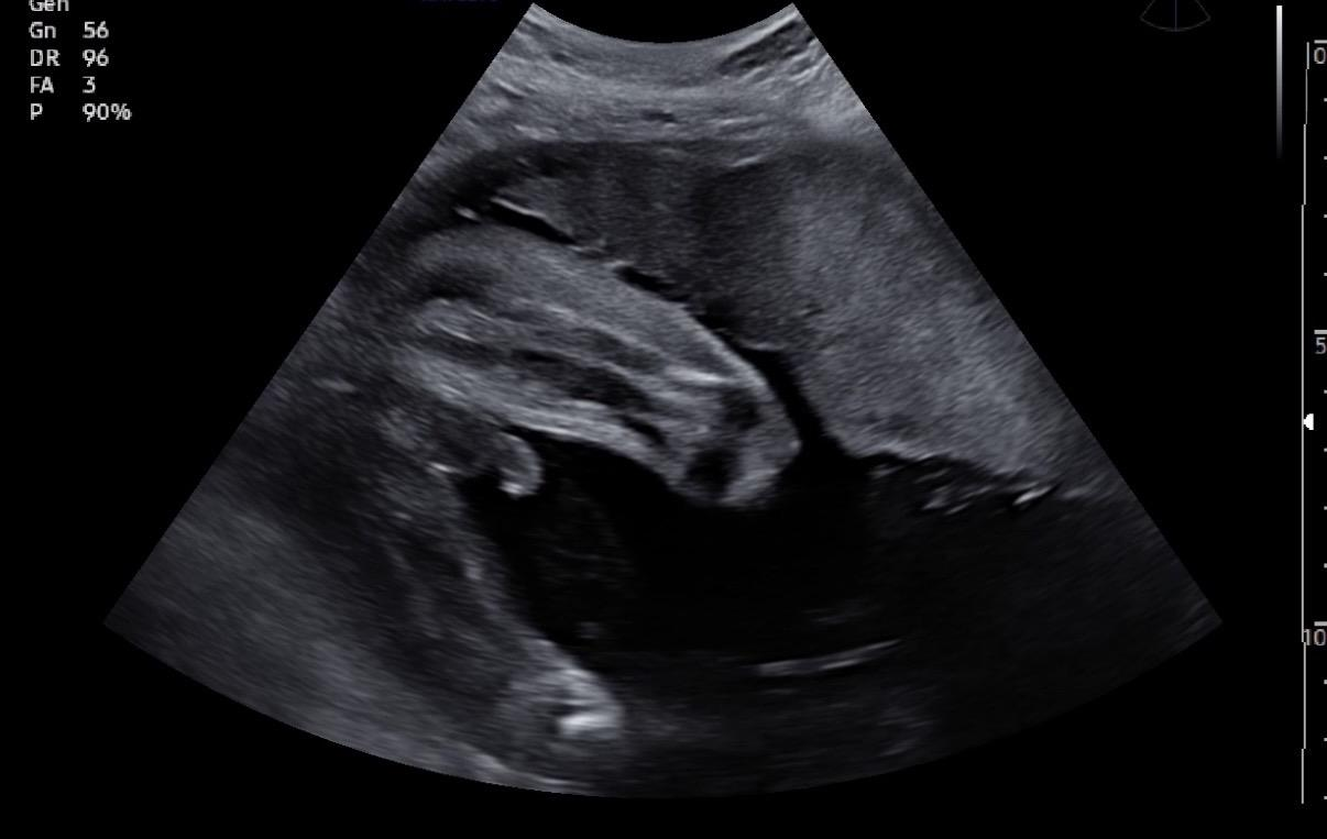 Picture17
