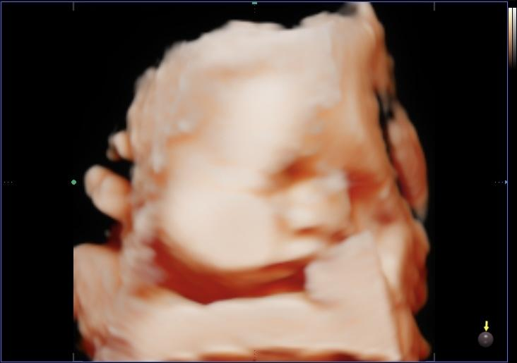Picture5